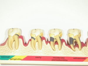 SHOFU DENTAL DIGITAL CAMERA