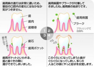 定期検診