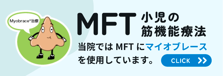 オプション:追尾バナー