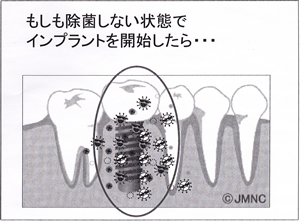 サンプル画像