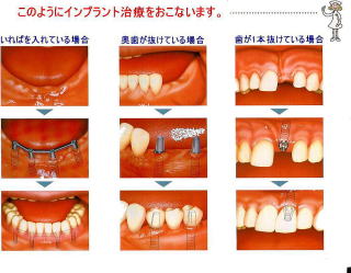 サンプル画像