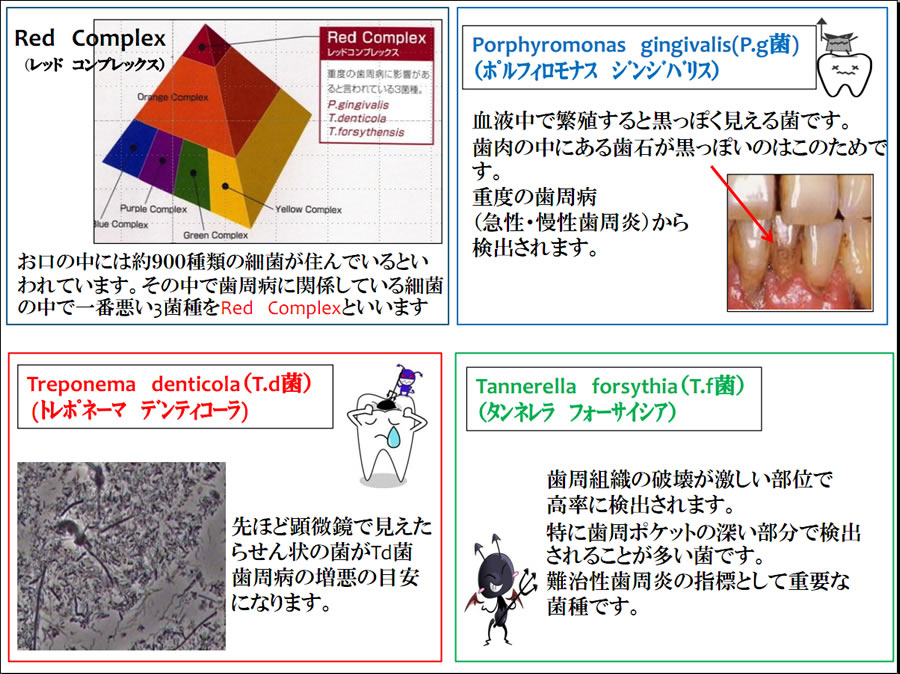 歯周病の予防は歯石を取り除くことです